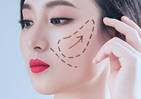丰苹果肌