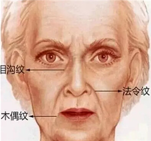 法令纹